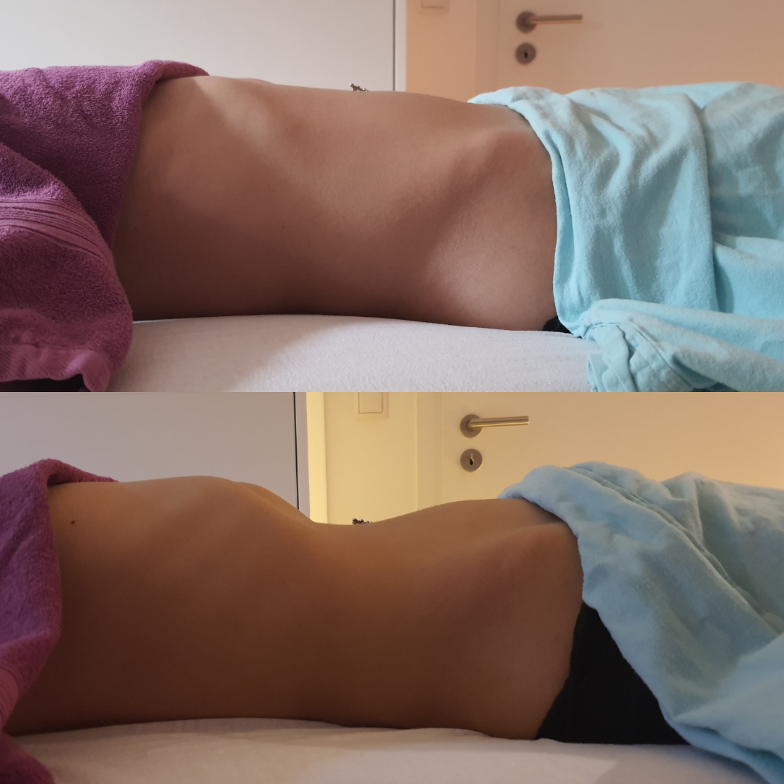 Brasilianische Lymphdrainage München Obersendling Wirkung vorher nachher Ergebnis